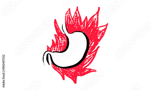 Gastroesophageal reflux pain