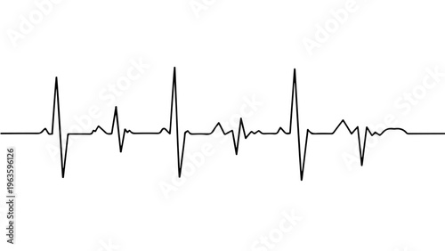 Graphical representation of a heartbeat pattern on an electrocardiogram strip