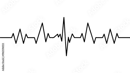 Graphic representation of an electrocardiogram showing heart rhythm patterns