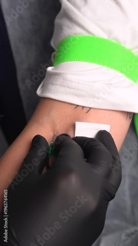 Vertical 4k shot of Professional medical procedure of blood sampling for platelete-rich plasma therapy