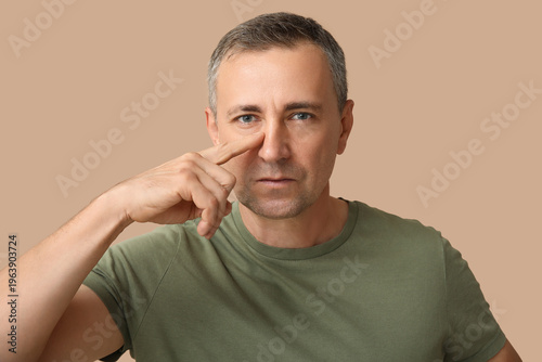 Ill mature man pointing at ...
