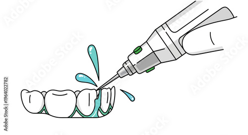 Vector illustration of dental scaling procedure with a modern ultrasonic device, emphasizing precision and oral hygiene for a healthy smile
