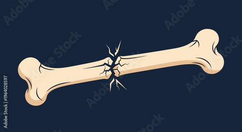 Illustration of a fractured human bone shown on a dark blue background to represent medical injury or trauma.