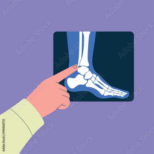 A medical professional examining an X-ray of a human foot