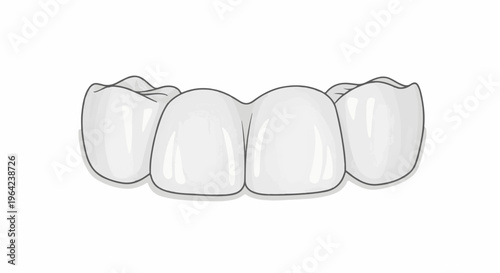 White dental bridge with four attached crowns, set against a white background