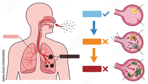 Diagram illustrates the process of inhaling particles leading to respiratory inflammation and immune response within the alveoli respiratory system lungs inhalation cells