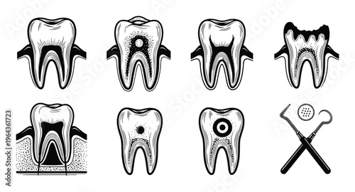 Dental health cross-section illustrations of teeth showing various stages of tooth decay with dental tools