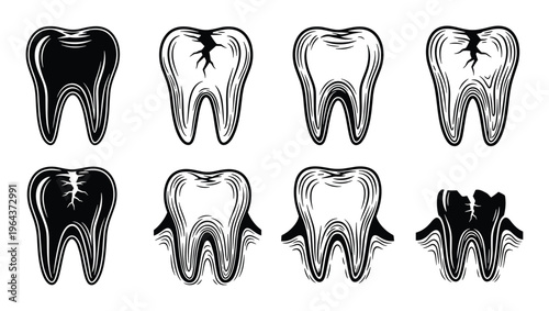Tooth decay progression stages vector illustration, from healthy to damaged tooth anatomy in black and white color scheme.