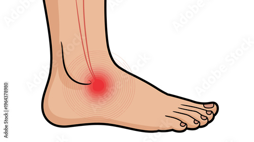 Human foot with ankle pain and red inflammation illustration