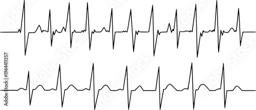 Rows of black electrocardiogram heart rhythm lines a white background medical