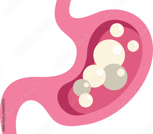 Human stomach showing gas bubbles causing bloating and discomfort, a medical illustration