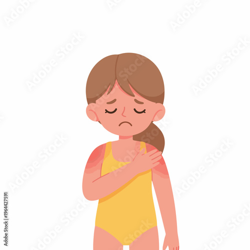 Sunburn Girl with Red Skin on Arm and Shoulder