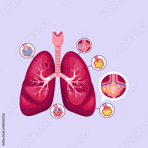 A detailed anatomical illustration of human lungs, highlighting their structure and function, providing an educational and insightful view of respiratory anatomy.