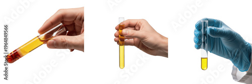 Bilde på lerret Laboratory hand holding test tube with vaccine liquid, Immunization, Vaccinum, Preventive Medicine, Virology Research, Clinical Lab Diagnostic, Medical Science Photography, Immunology