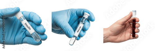 Cuadro en lienzo Laboratory hand holding test tube with insulin medicine, Diabetes Treatment, Hormone Therapy, Pharmaceutics, Medical Research, Clinical Pharmacology, Healthcare Science Photography