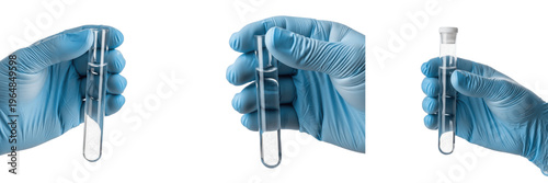 Canvas Print Scientist hand holding test tube with sputum disease testing sample, Pulmonology Research, Phlegm Analysis, Clinical Lab, Medical Science Photography, Respiratory