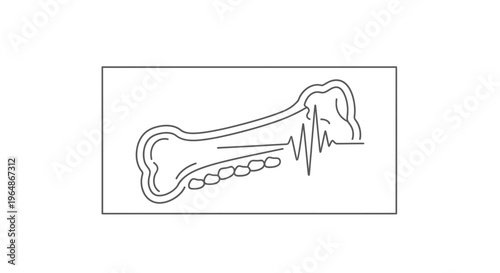 Skeletal Health Diagnostic Illustration Featuring Bone Structure and Pulsating Signal for Medical
