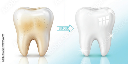 Teeth Whitening Before and After Comparison with Stained and Clean Tooth Illustration Showing Dental Care, Oral Hygiene Improvement, Treatment Results, and Healthy Smile Concept