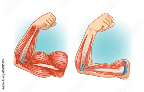 Healthy Muscle vs Arm Muscle Loss Aging Comparison