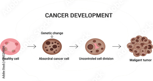 Cancer development stages medical infographic showing healthy cell genetic mutation uncontrolled cell division and malignant tumor formation biology education vector