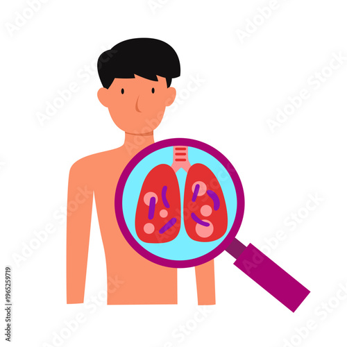 mycobacterium tuberculosis infection disease concept.