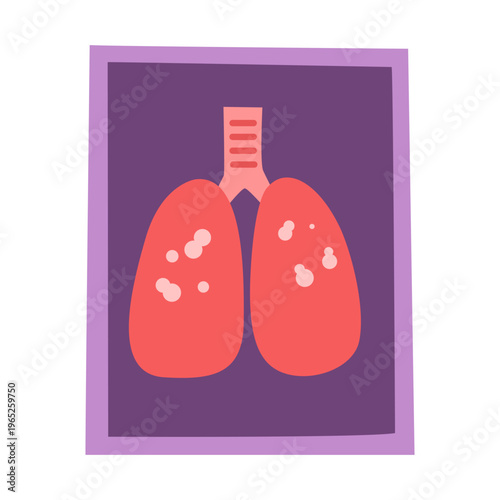 mycobacterium tuberculosis infection disease concept.