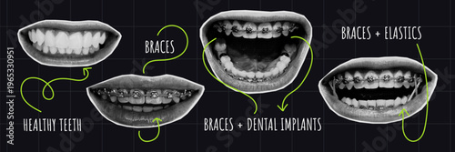 Infographic of dental conditions and orthodontic treatments showing healthy teeth, braces, implants, and elastics. Educational visual for dentistry, oral care, and smile correction