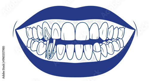 Dental Health Check: Uneven, Damaged Teeth and Gums, Cavity Illustration