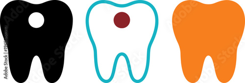 Flat design vector illustration showing three stages of tooth decay for dental health education, infographics, or medical presentations.