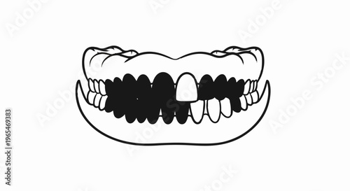 A black and white illustration of a set of dentures, with some teeth missing