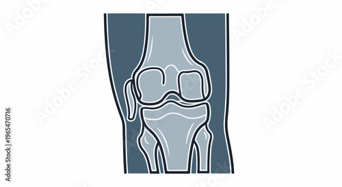 Simplified illustration of a human knee joint