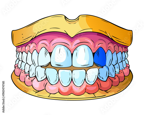 Human jaw and teeth showing a single blue tooth representing a dental crown implant or a specific medical condition in dentistry