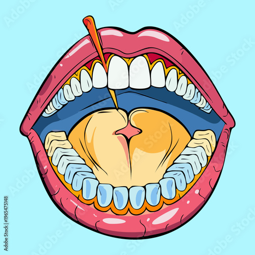 Anatomical illustration of human mouth with a needle for dental anesthesia training and professional oral health surgery educational materials and