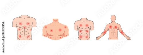 Human body with red skin spots.