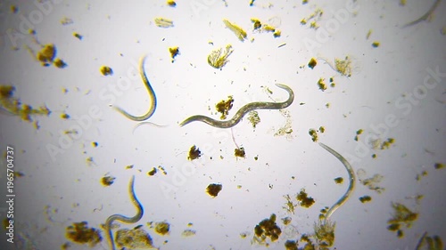 Nematodes with minimal movement among detritus panoramic view under 100x magnification brightfield microscopy. 4K scientific microscopy footage.