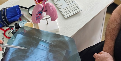 Doctor talking to patient and x-ray of lungs with pneumonia and bronchitis