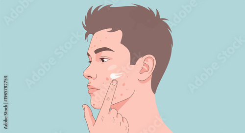 Close-up profile of a young man applying cream to his acne-prone skin