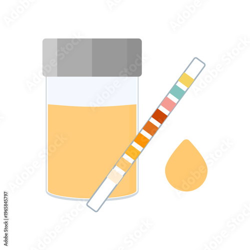 Urine sample cup and urinalysis reagent strip for kidney exam, urinary tract infection and cystitis diagnostics. Ketone and PH rapid test strips for ketogenic and alkaline diets. Vector illustration.