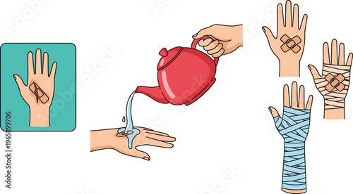 Hand Injury Care Process, Featuring Bandaging and First Aid Treatment with Water Pouring and Wrapping Techniques in a Cartoon Style