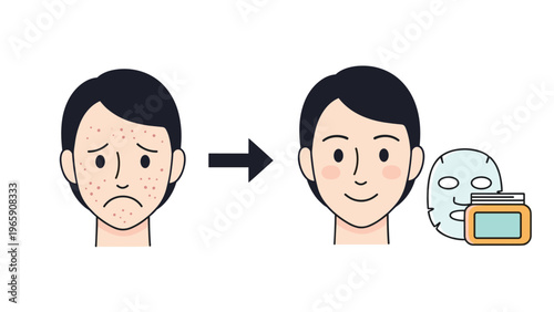 Illustration showing a before and after skin care routine for a person with acne using facial cleansing products.