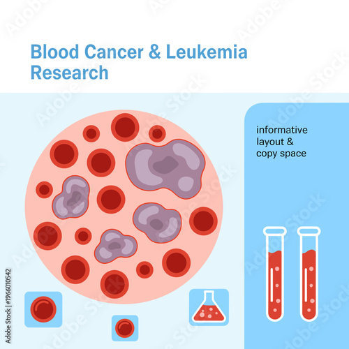 Blood cancer and leukemia research concept with blood cells and test tubes