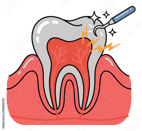 Cartoon illustration of a sensitive tooth cross section depicting dental pain and nerve sensitivity for oral health design