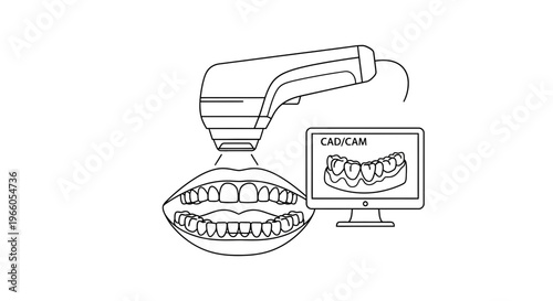 Dental CAD/CAM Scanner and Digital Impression of Teeth