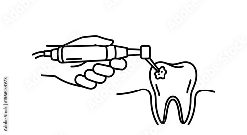 Dentist using drill to remove cavity from tooth, dental care concept