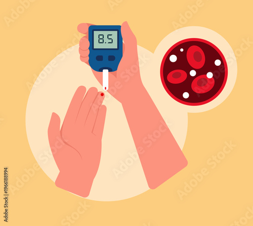 Diabetes Mellitus - Blood Sugar Monitoring Device - HbA1c- Stock Illustration