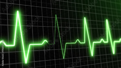 A bright green electrocardiogram waveform displays on a dark digital monitor, representing a healthy heartbeat and vital signs