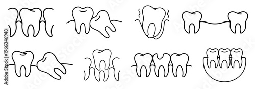 Dental Tooth Conditions Set Showing Healthy Teeth in Gum, Crowding with Tilted Wisdom Tooth, Loose Tooth Mobility, Missing Tooth Gap, Impacted Tooth in Jaw, Supernumerary