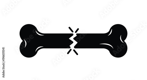 A black and white illustration of a fractured bone depicting a break