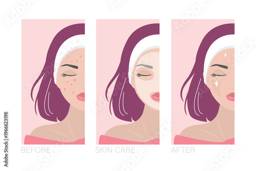 Women skin care. Young adult, close up view, beauty female character. Young girl acne treatment before and after, facial cleansing foam, cream, skincare,