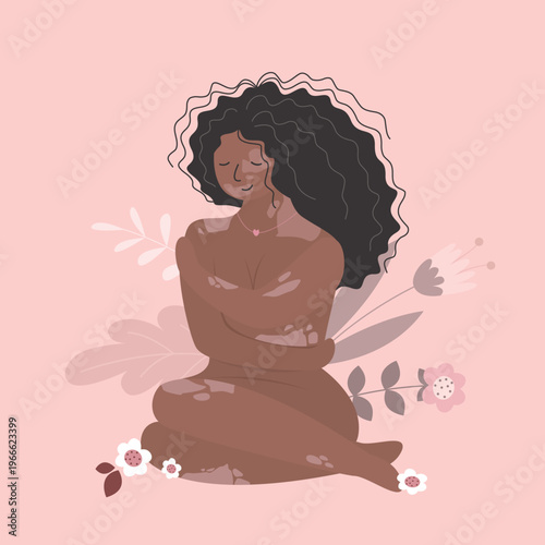 Young woman with vitiligo on various parts of body. Happy strong girl with pigmentation on skin. African american female character with Vitiligo skin problems.